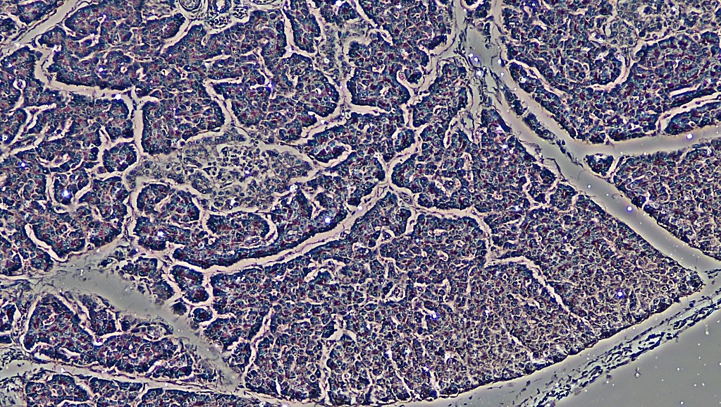 Thin Capsule of Human Pancreas by Phase Contrast | cross sec… | Flickr