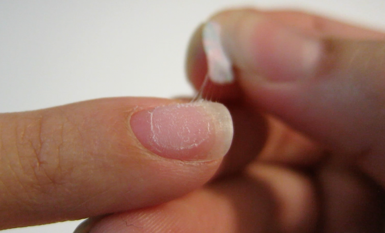 Effects of Acetone on Skin