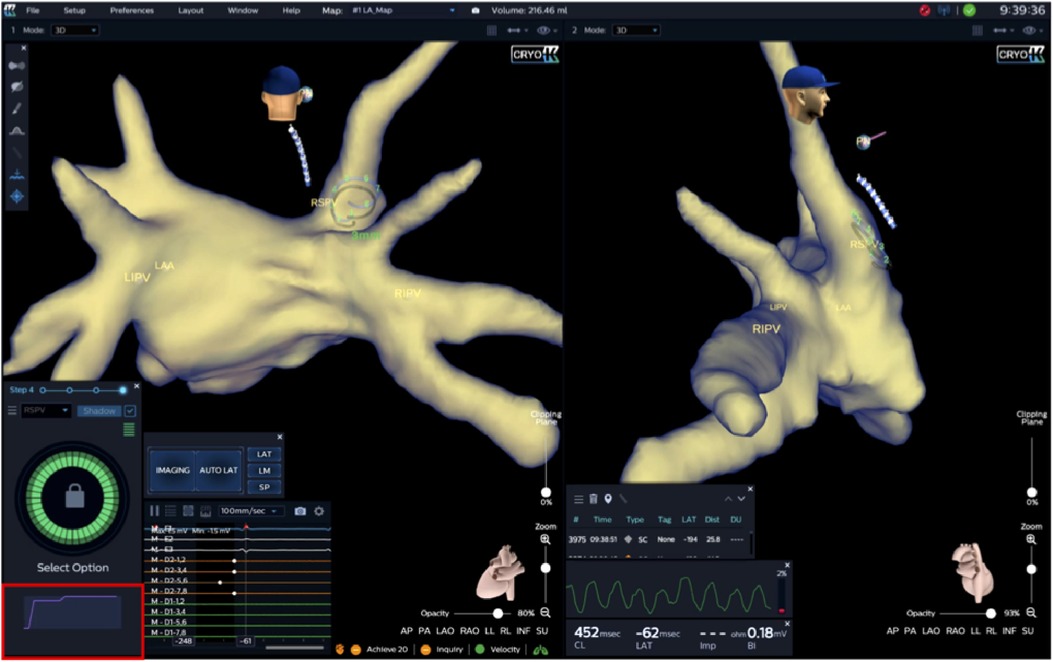 Iranians Can Achieve Progress, Glory Only through Resistance: Official ...